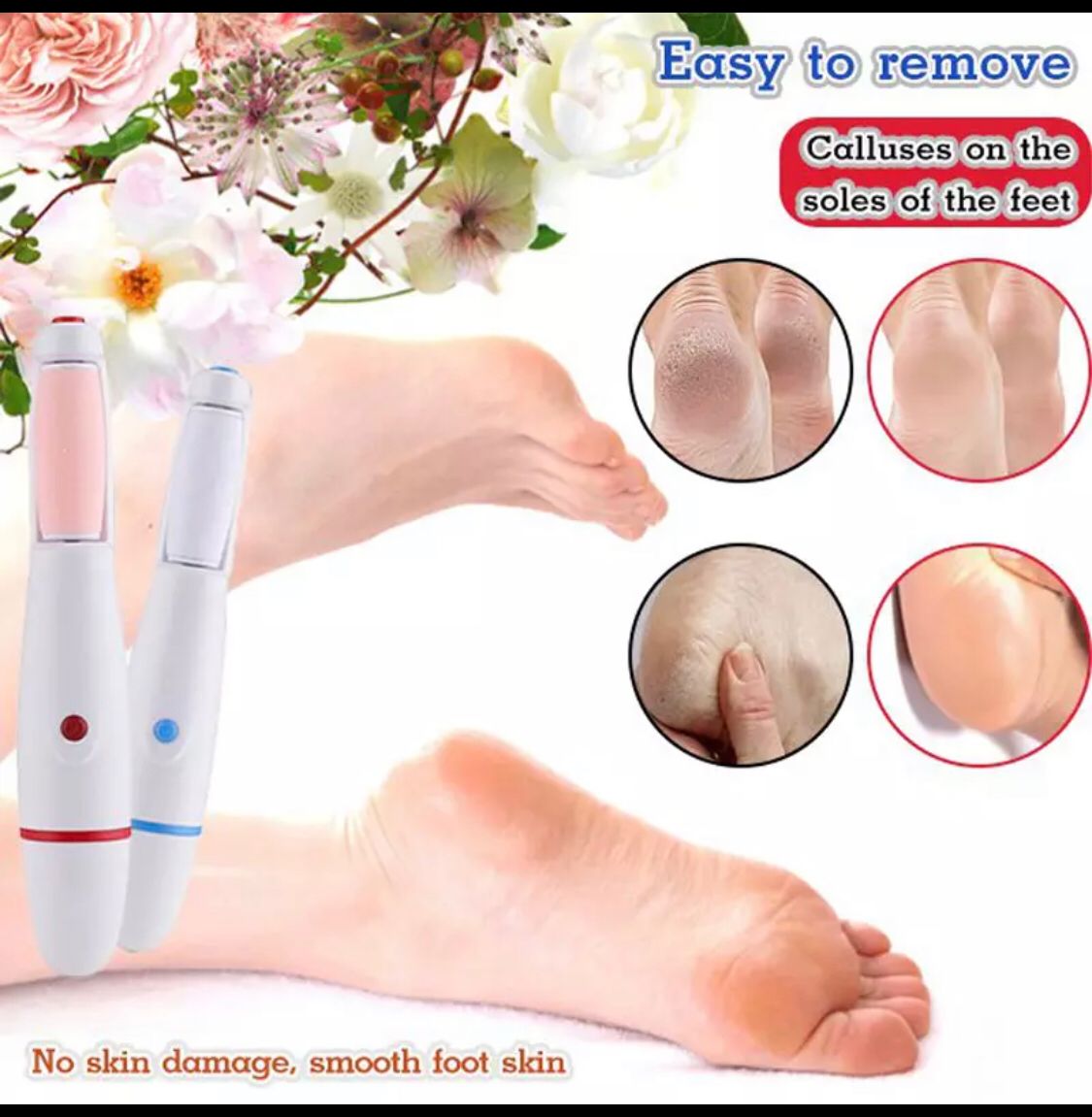 Foot Back Callus Remover (random Color) TheUrbanMart